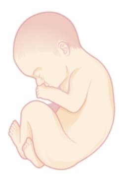 Foetus